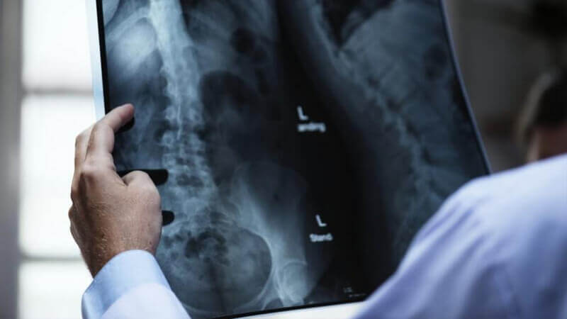 Will My Chiropractor Take An X-ray?
